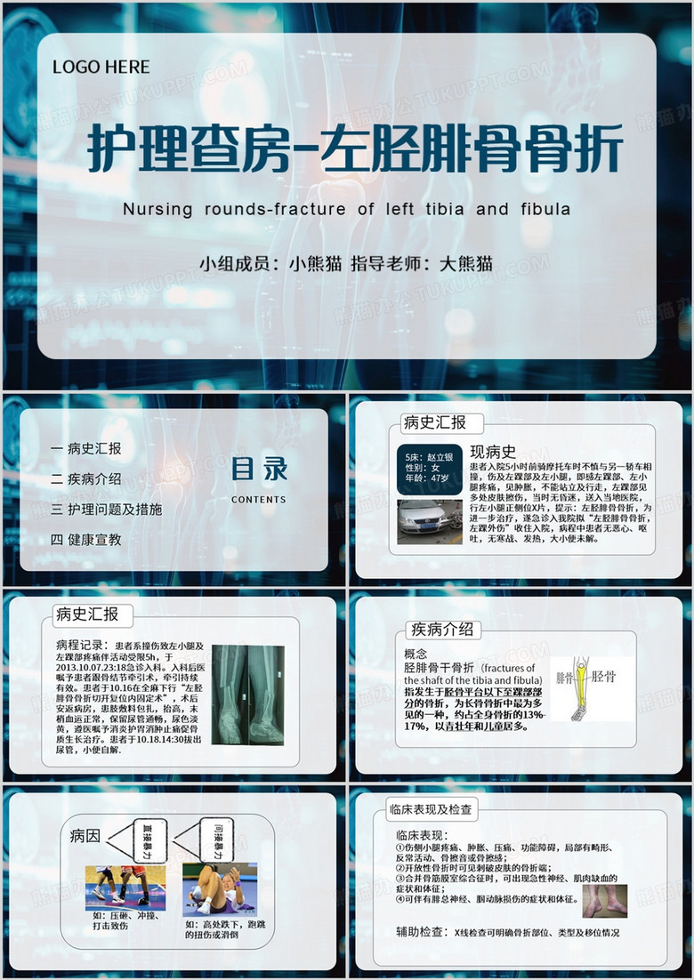 蓝色简约风左胫腓骨骨折护理查房PPT模板