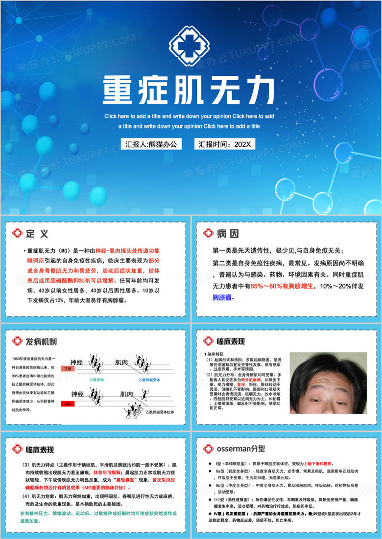 蓝色重症肌无力课件介绍PPT模板