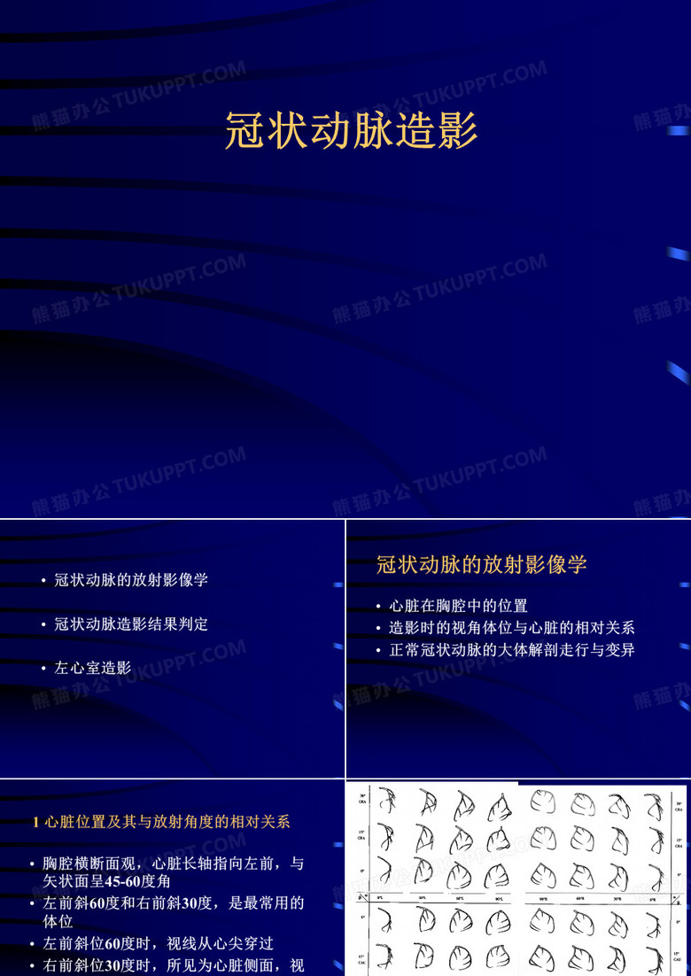 冠脉造影