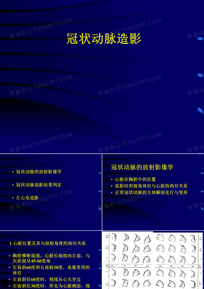 冠脉造影