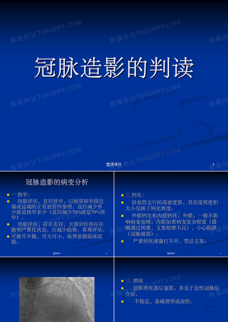 冠脉造影的判读