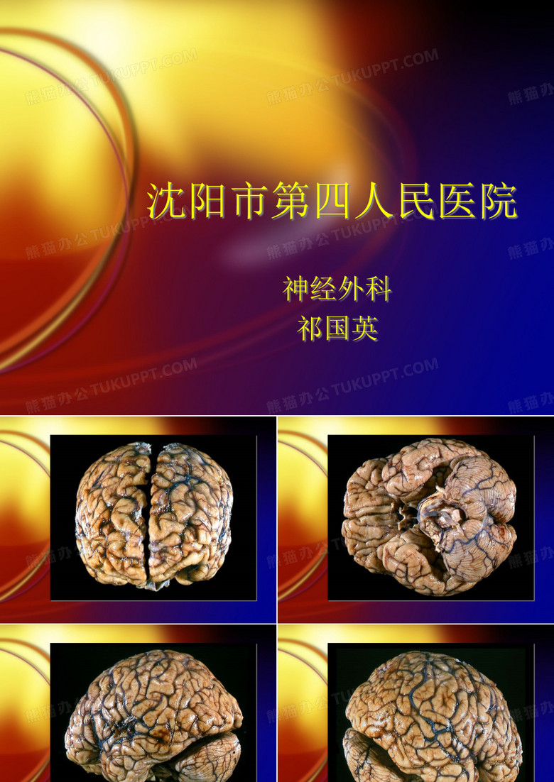 脑疝