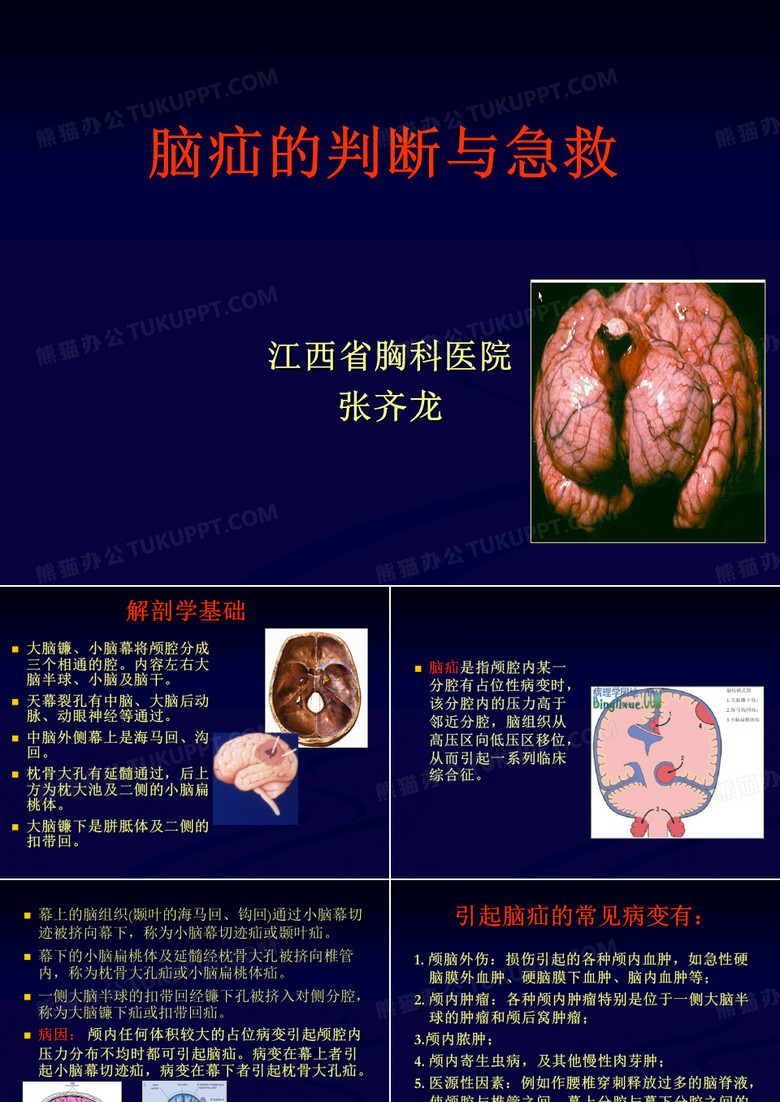 脑疝的诊治