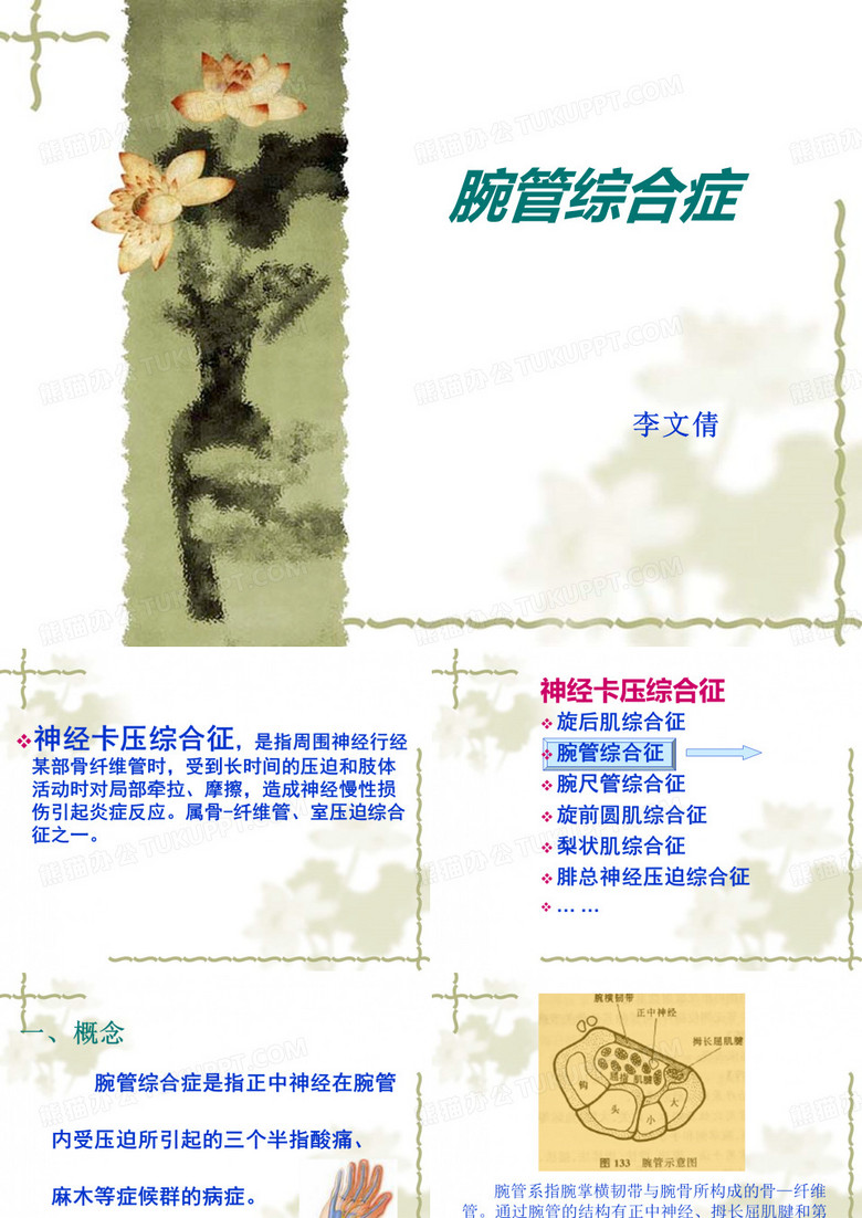腕管综合征