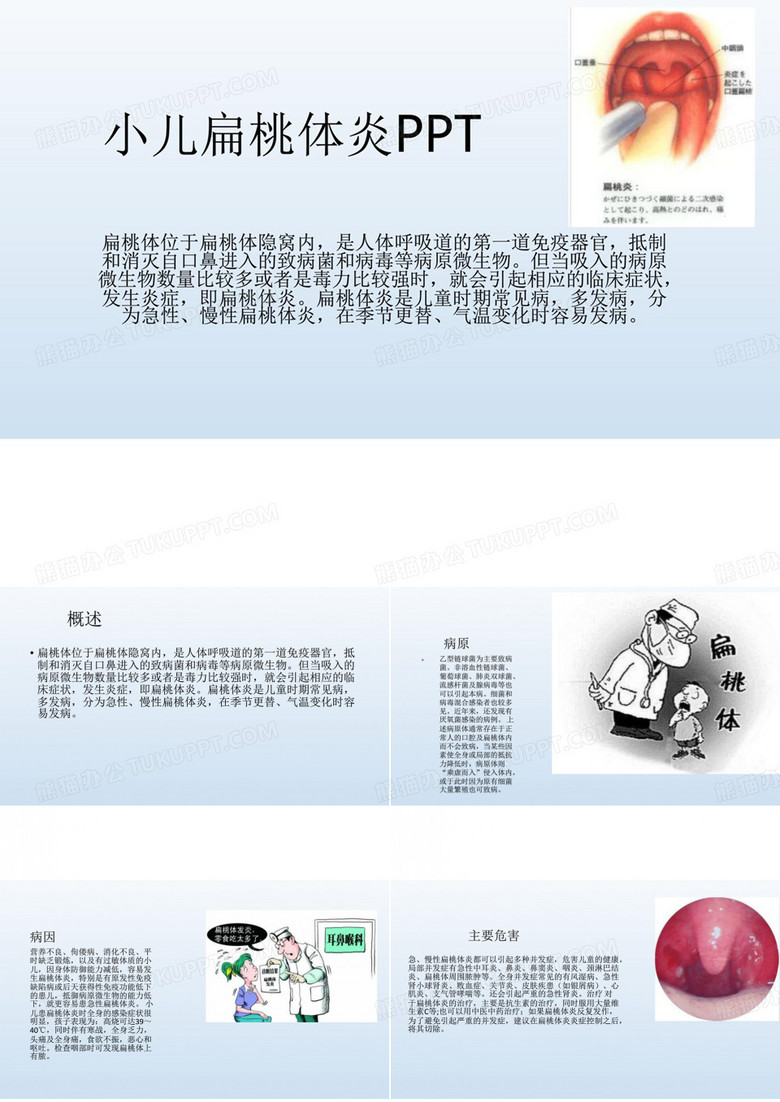 小儿扁桃体炎