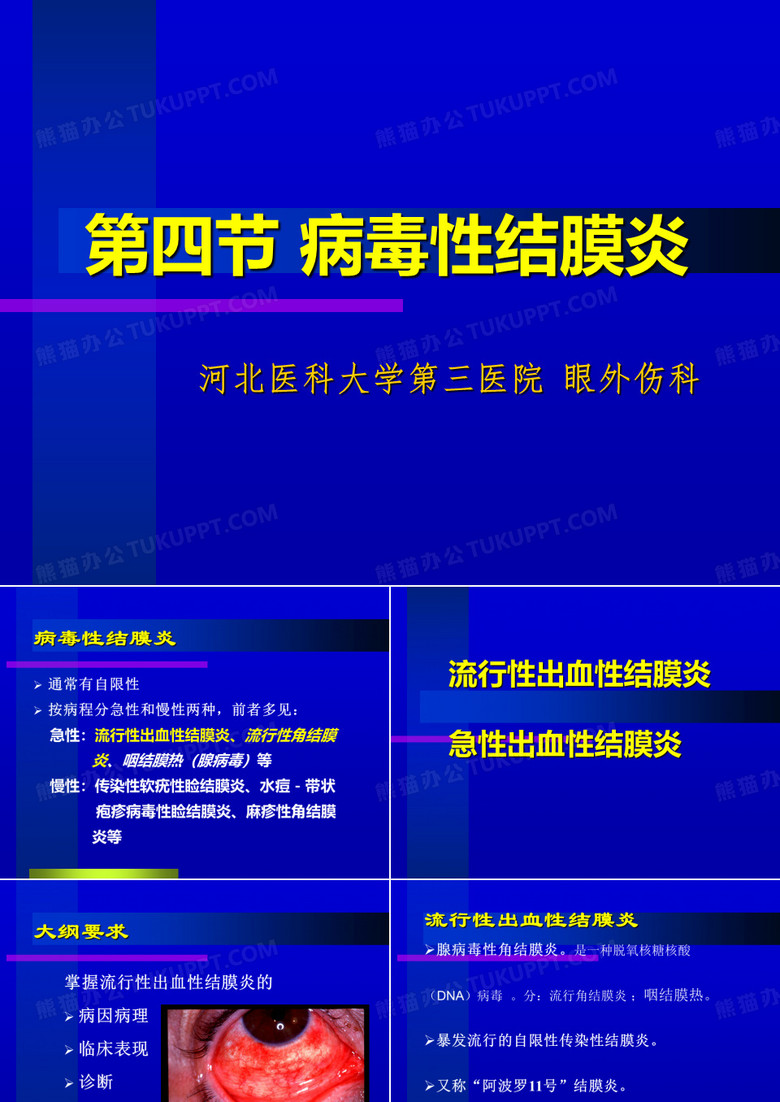 病毒性结膜炎