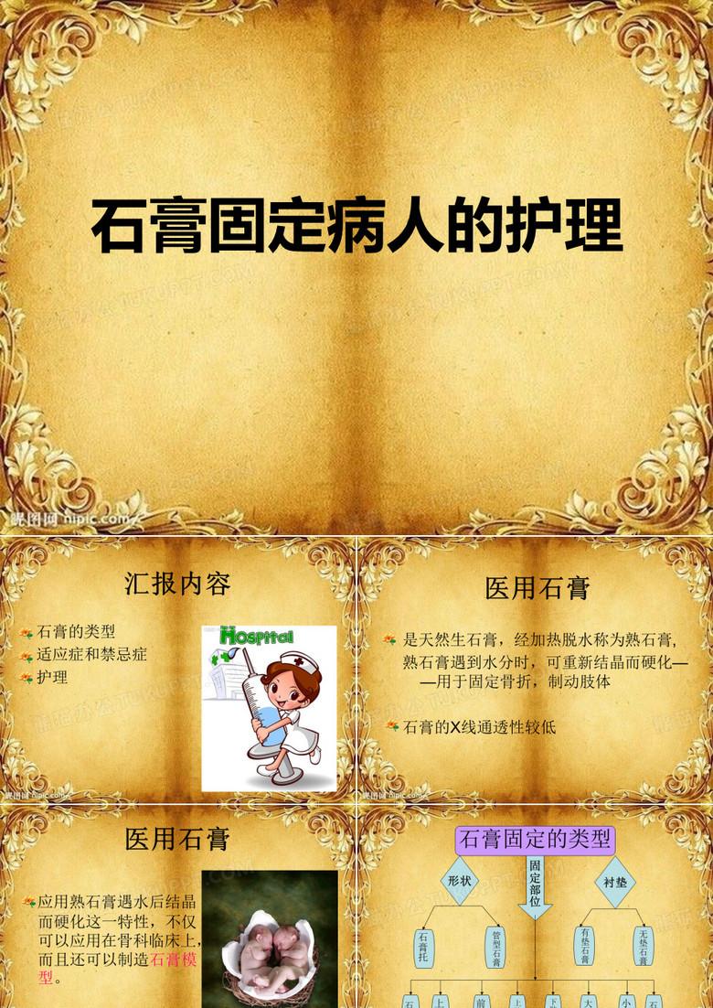 石膏固定的护理