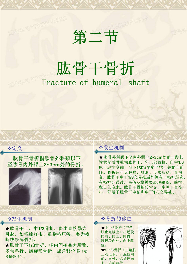 肱骨干骨折 (课件).
