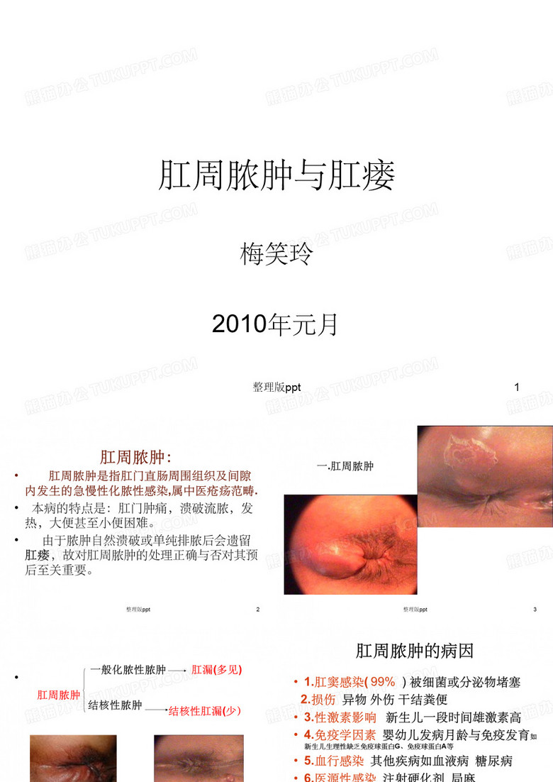 肛周脓肿与肛瘘