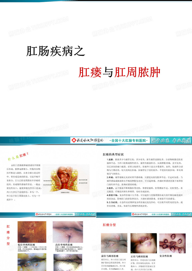 肛瘘与肛周脓肿