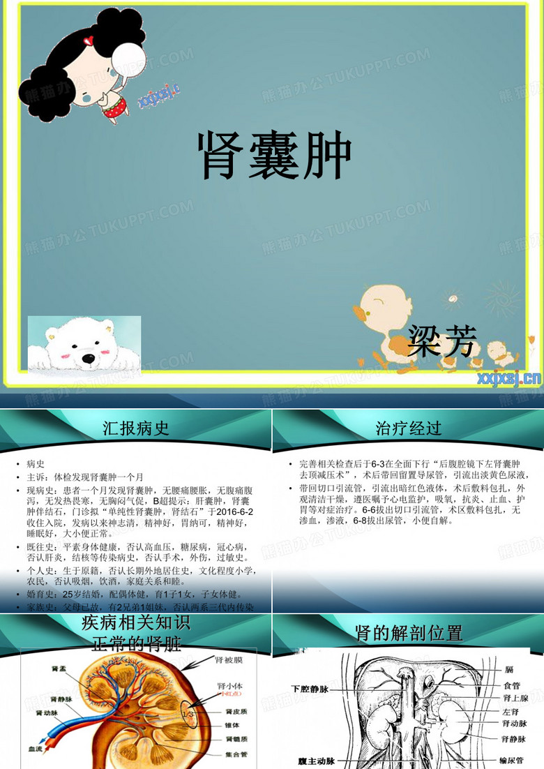 肾囊肿