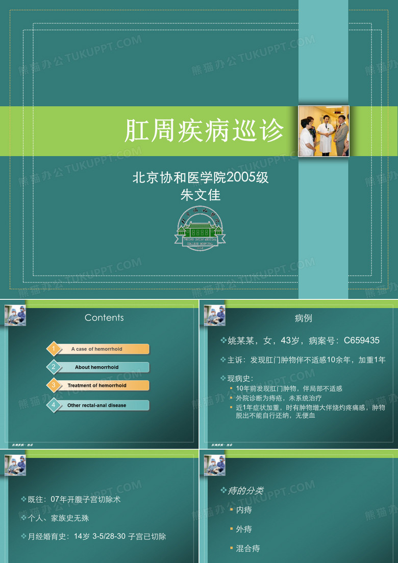 混合痔