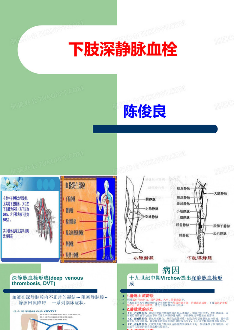 下肢深静脉血栓
