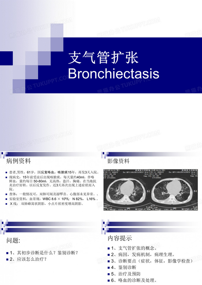 支气管扩张
