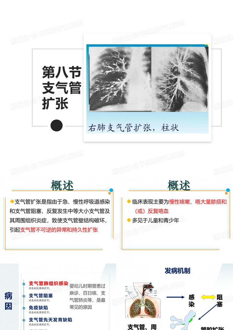 支气管扩张