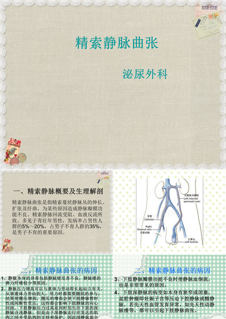 精索静脉曲张