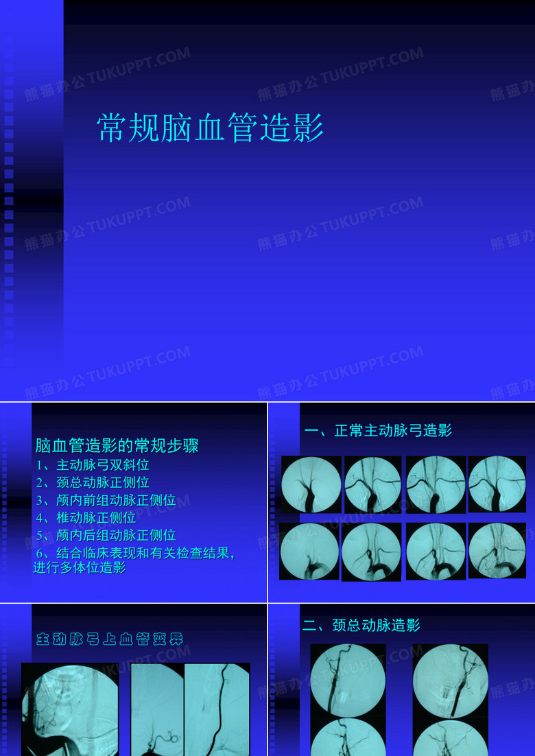 常规脑血管造影