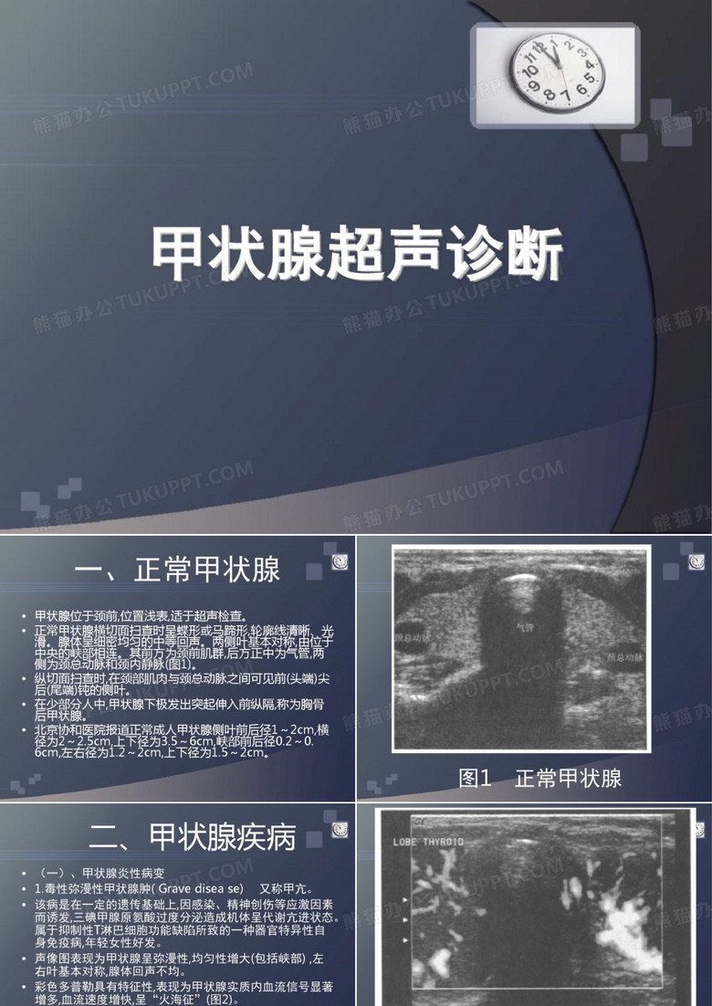 甲状腺超声表现