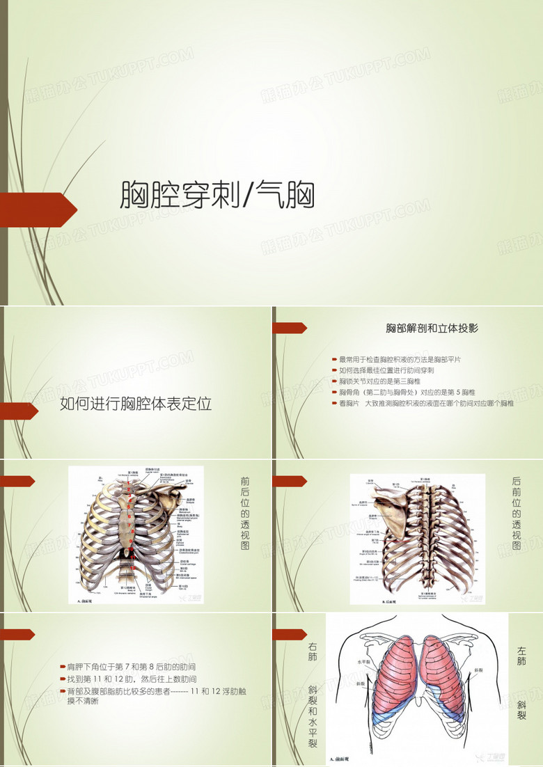 胸腔穿刺