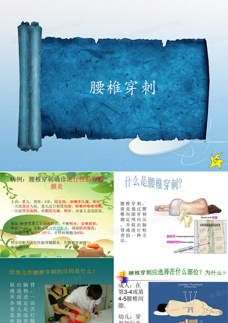 腰椎穿刺