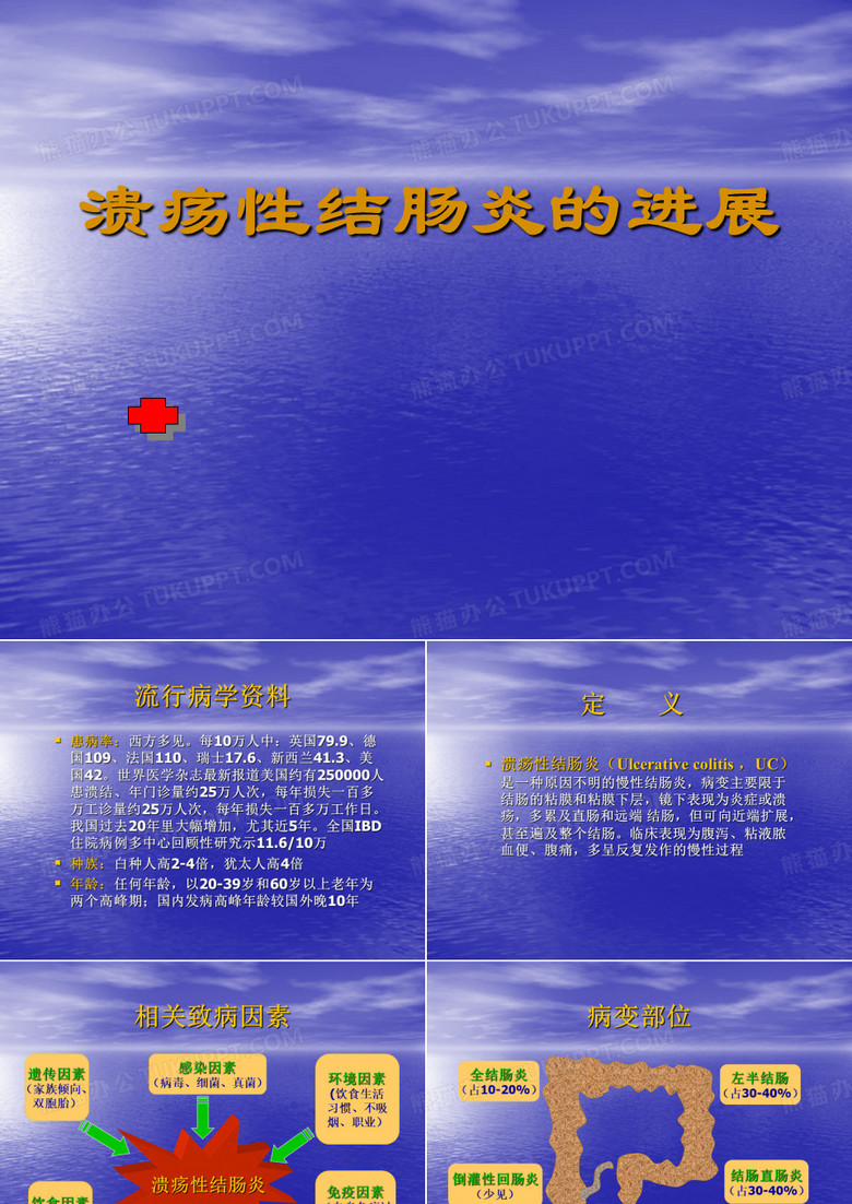 溃疡性结肠炎