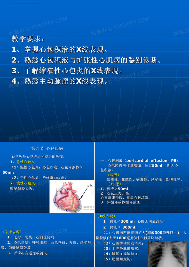 心包积液课件