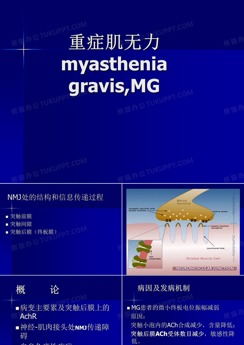 重症肌无力