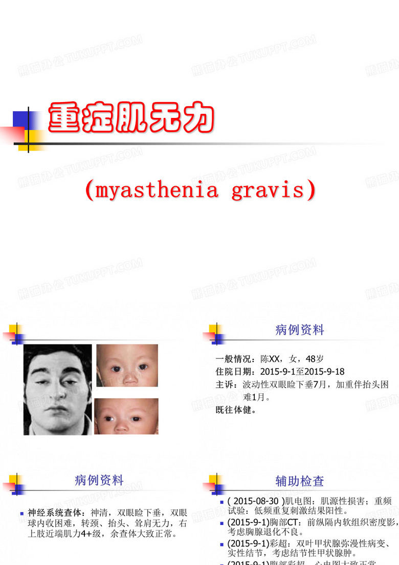 重症肌无力