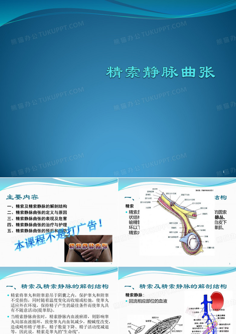 精索静脉曲张