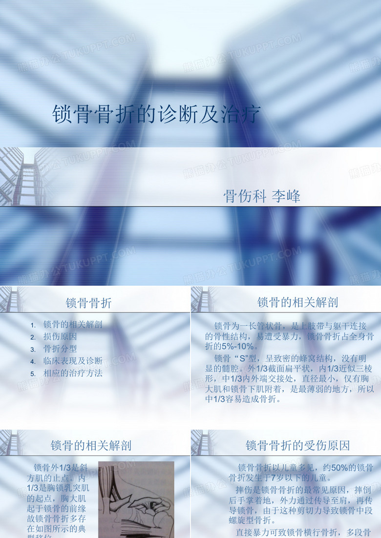 锁骨骨折