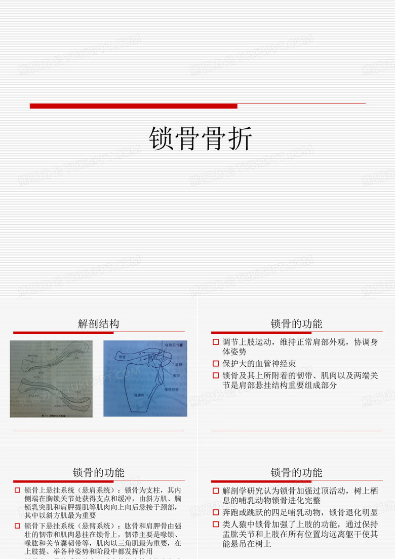 锁骨骨折