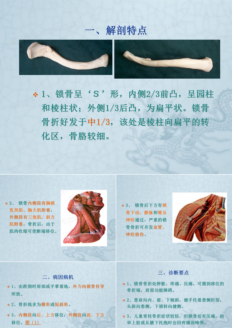 锁骨骨折 