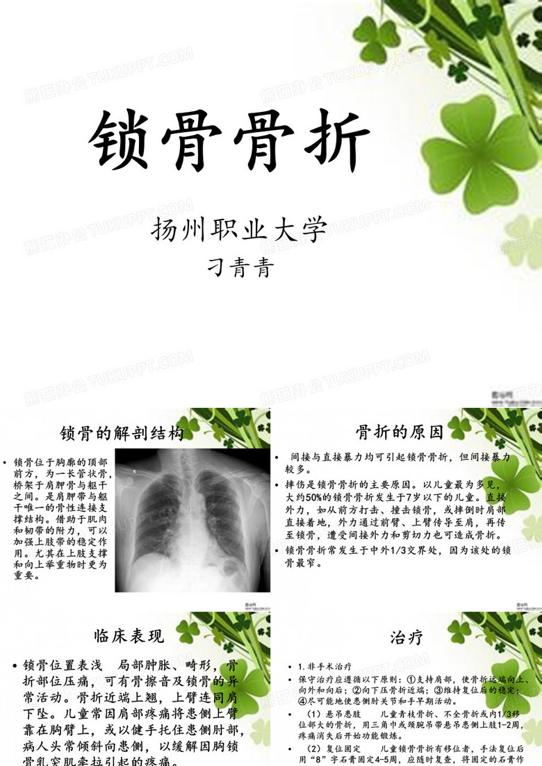 锁骨骨折