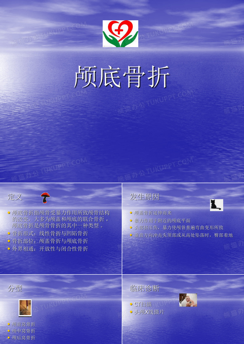 颅底骨折