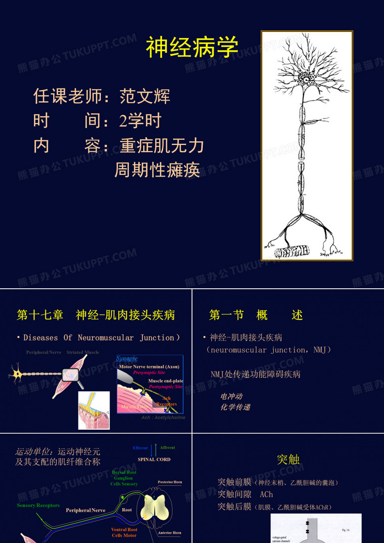 重症肌无力