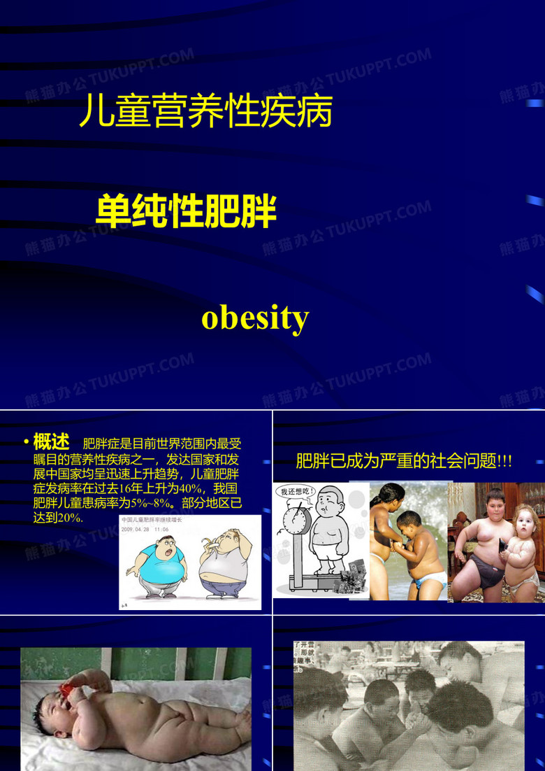 儿童单纯性肥胖