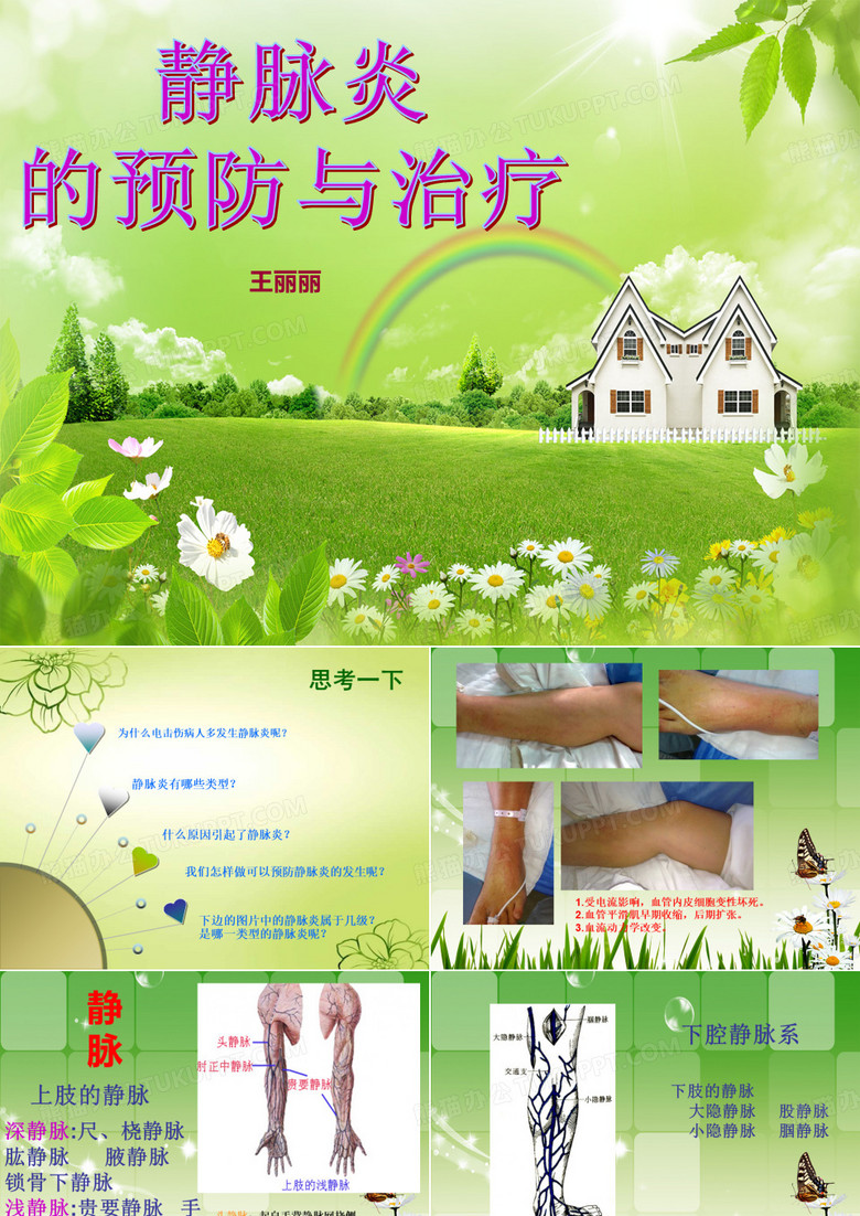 静脉炎