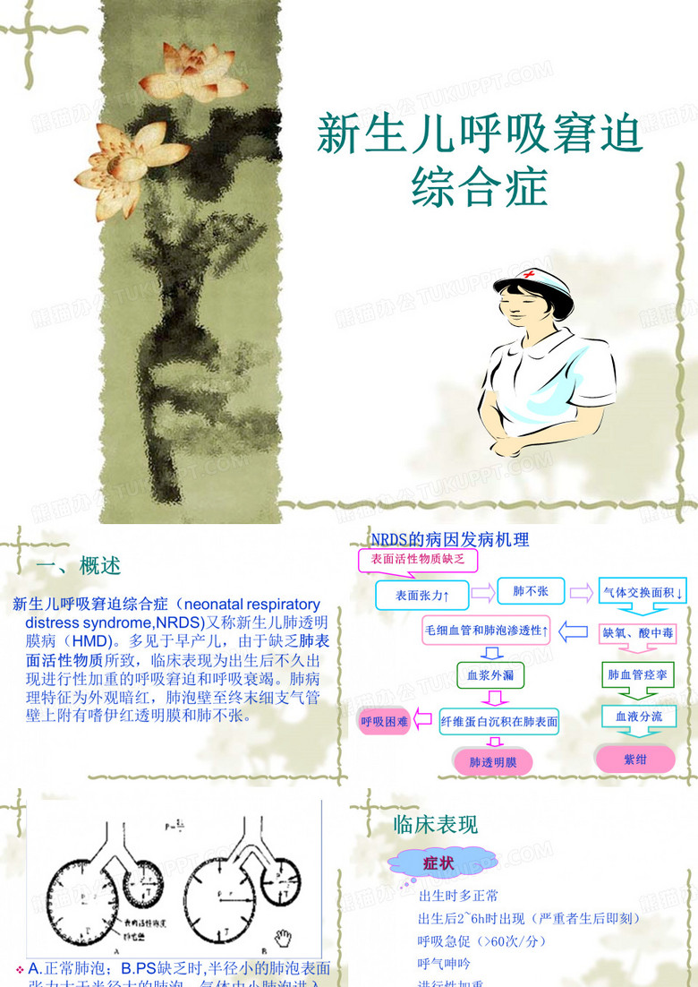 新生儿呼吸窘迫综合征