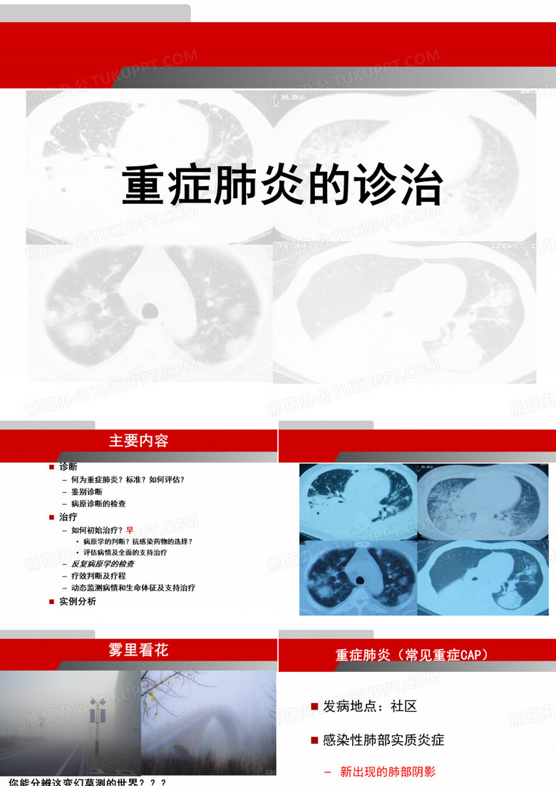 重症肺炎的诊治
