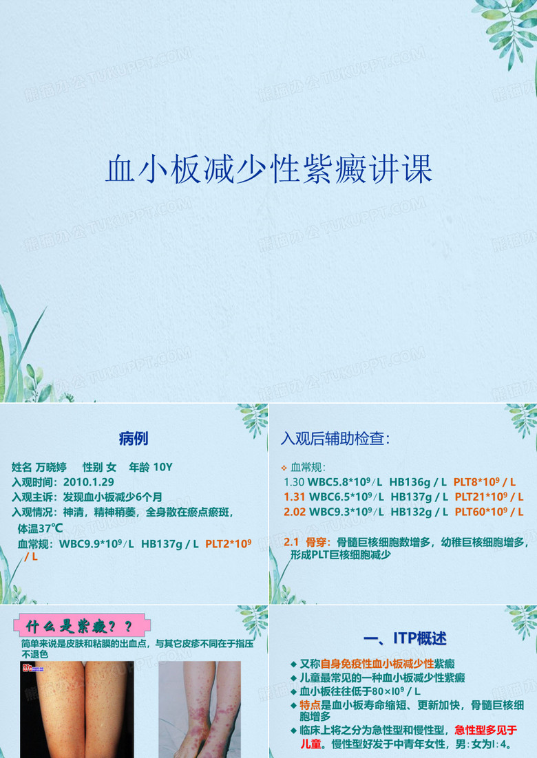 血小板减少性紫癜讲课