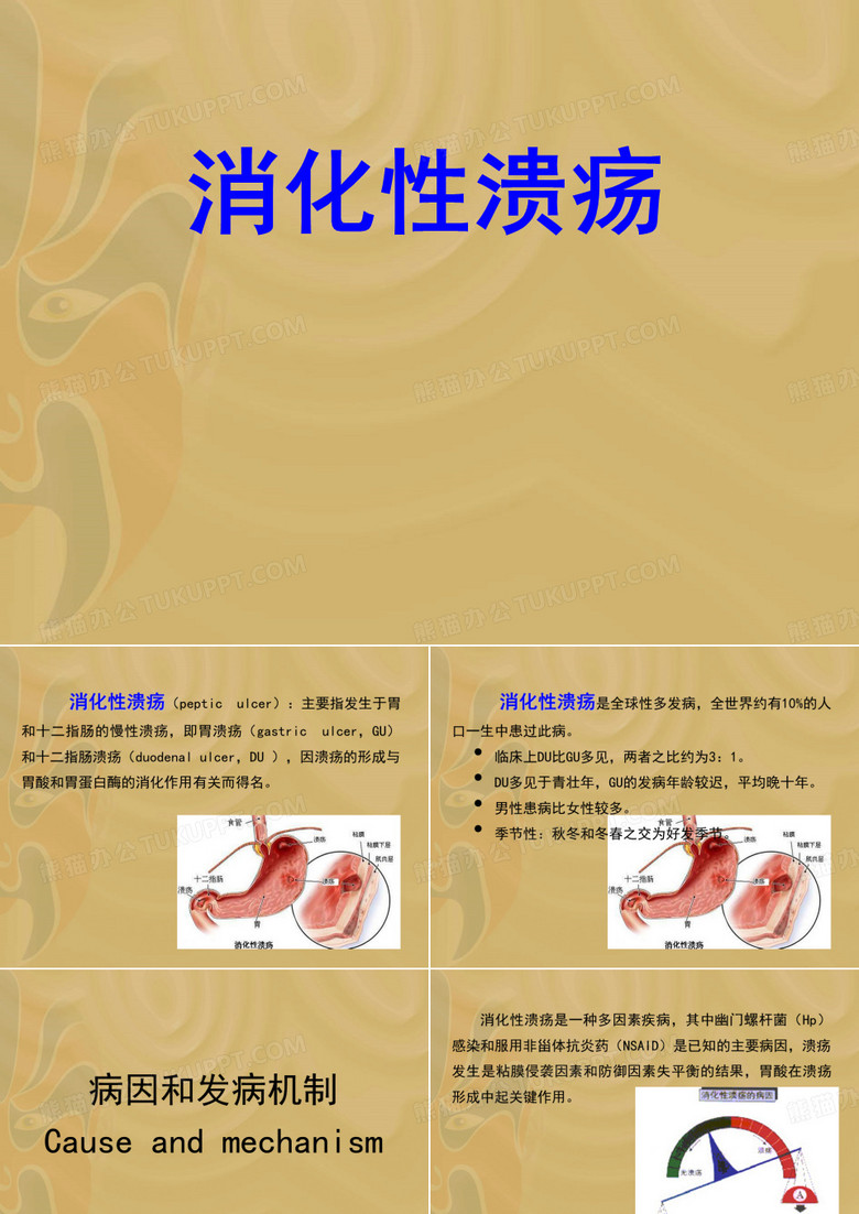 消化性溃疡
