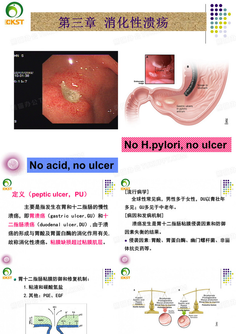 消化性溃疡