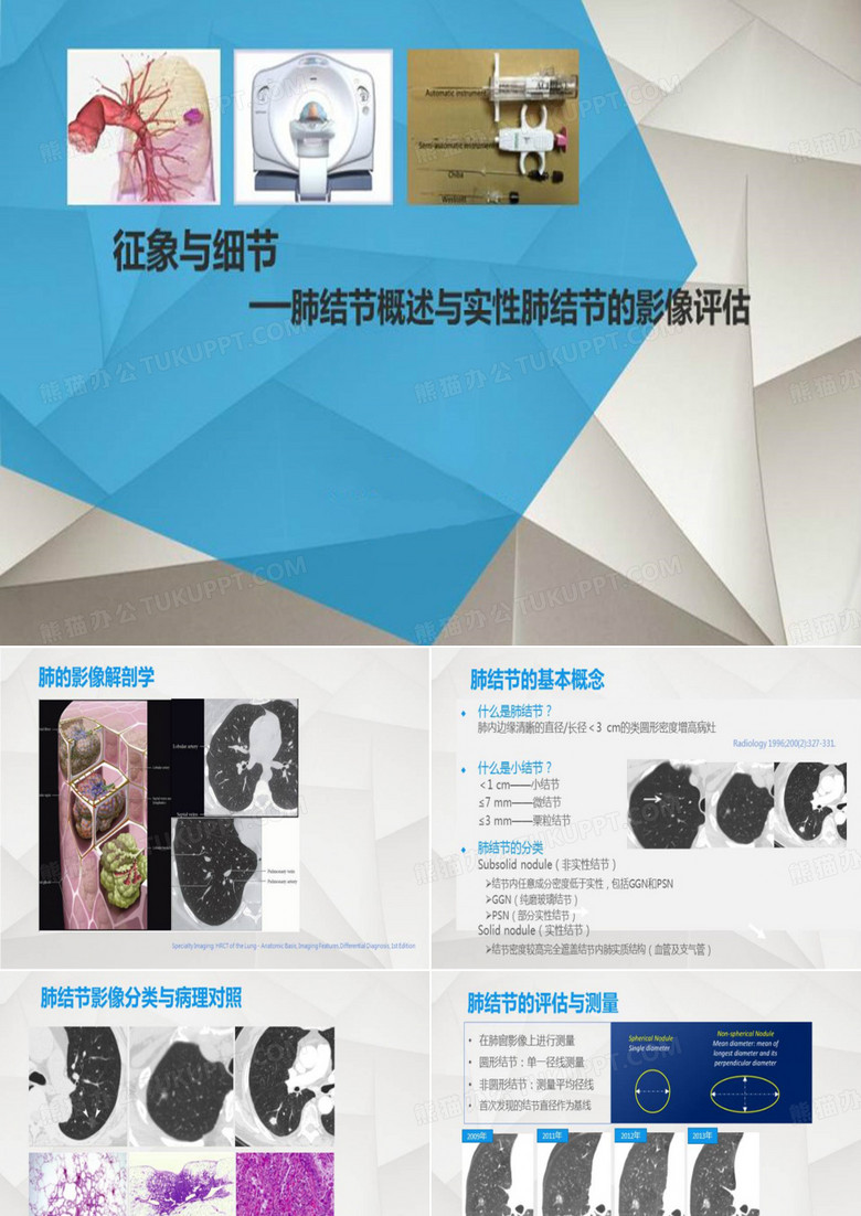 肺结节概述与实性肺结节的影像评估