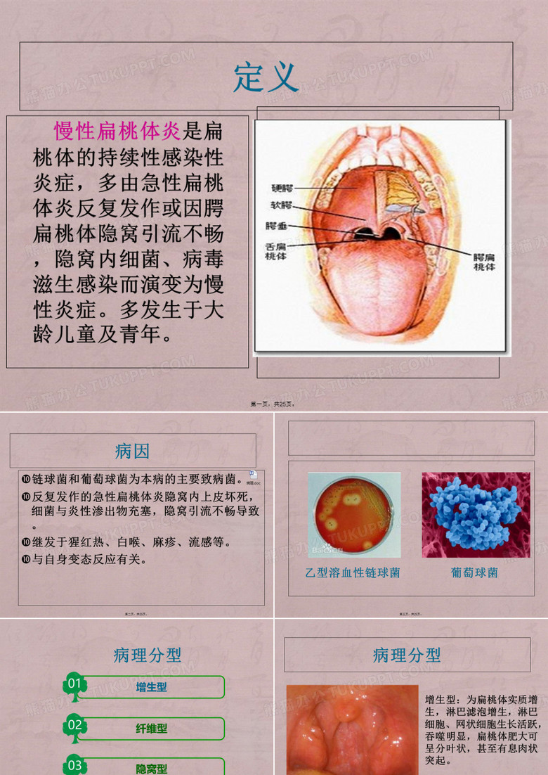 慢性扁桃体炎