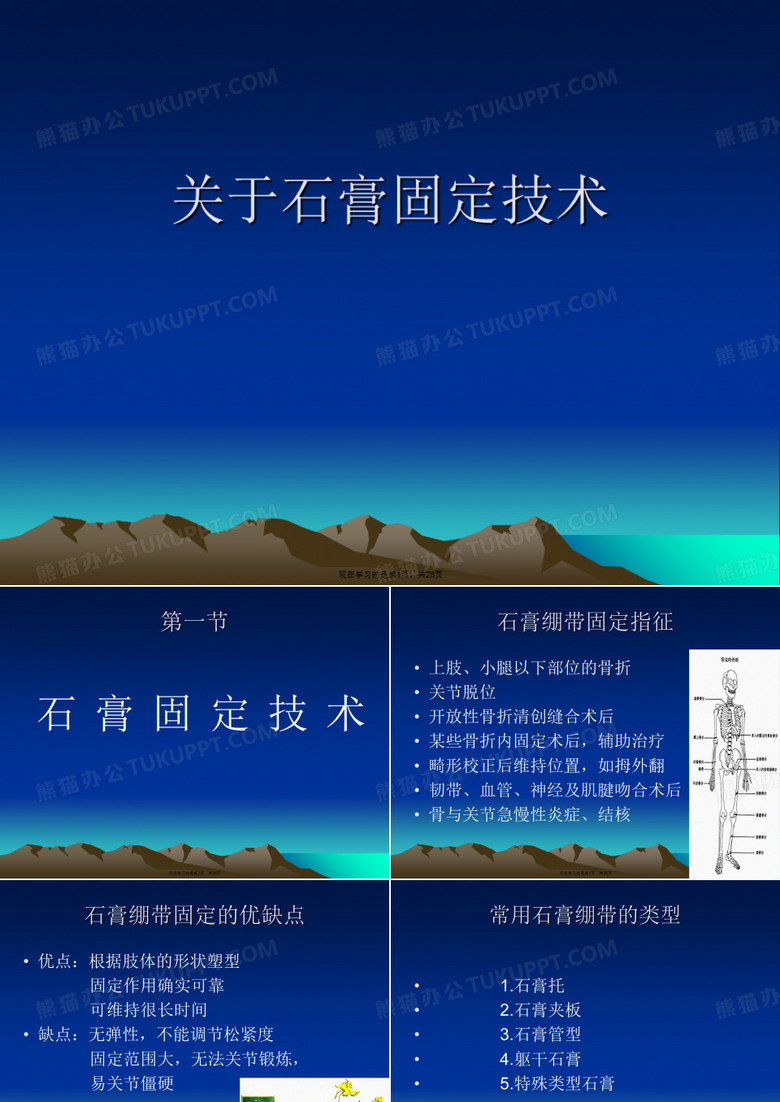 石膏固定技术