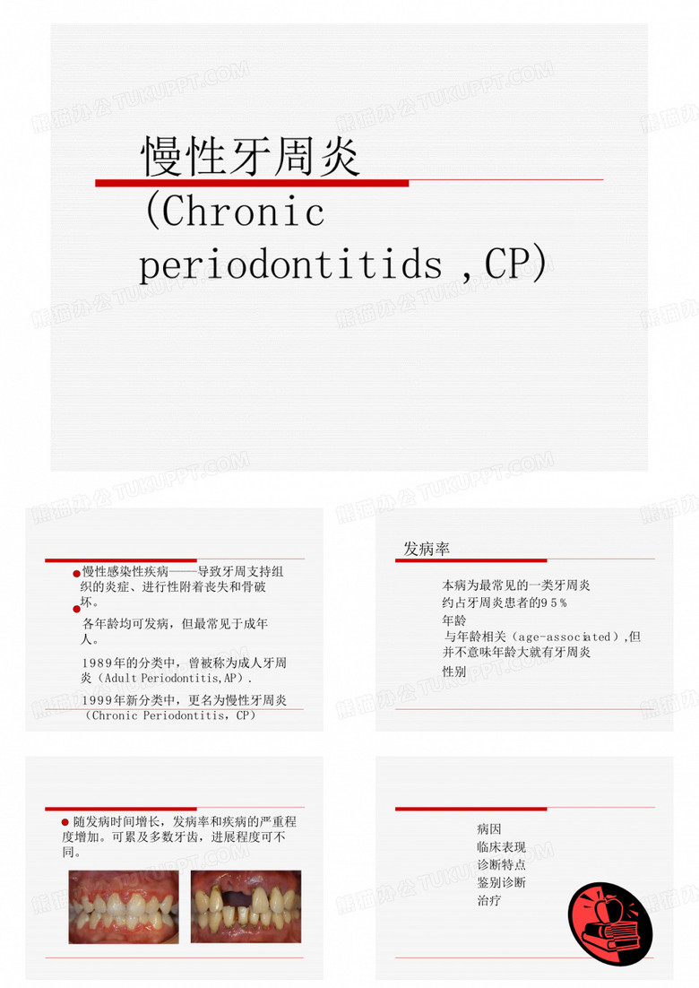 慢性牙周炎侵袭性牙周炎