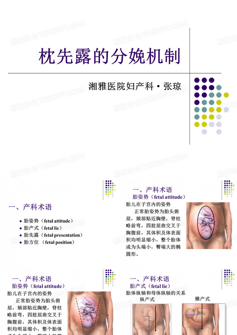 分娩机制