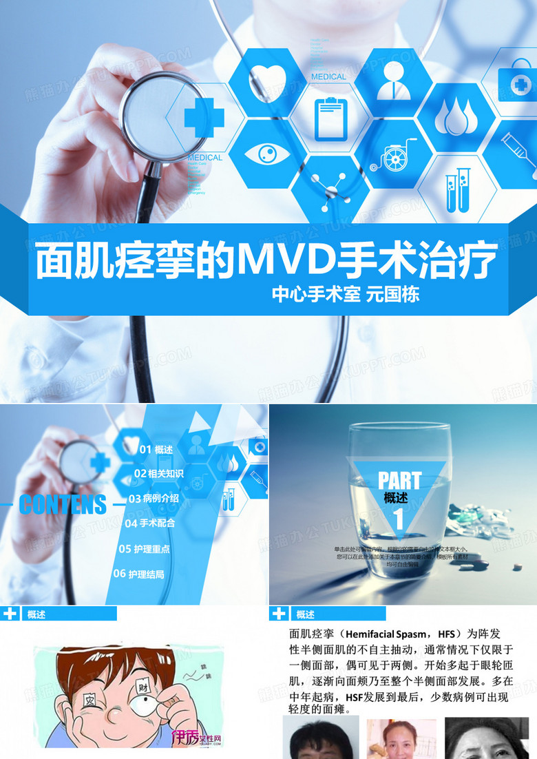 面肌痉挛手术