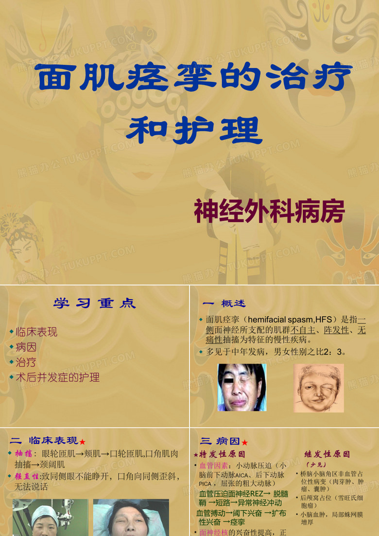 面肌痉挛ppt