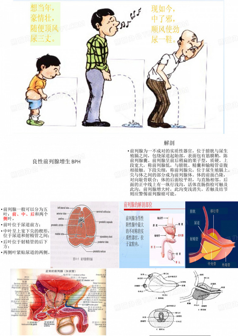前列腺增生-